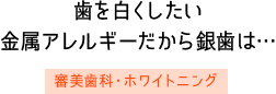 歯を白くしたい金属アレルギーだから銀歯は…　審美歯科・ホワイトニング