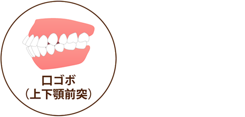 口ゴボ