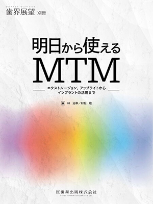 明日から使えるMTM