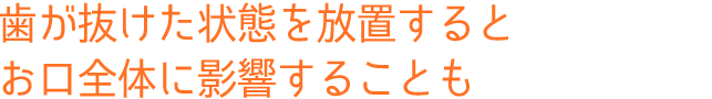 歯が抜けた状態を放置すると、お口全体に影響することも